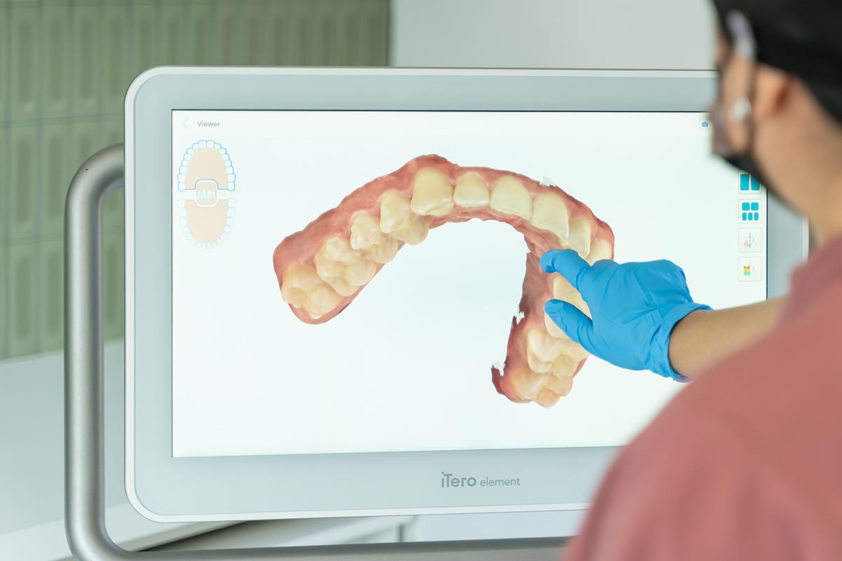 Clínica Dental Humma en Mérida, Yucatán - Tecnología dental Airflow, pantalla de captura molde dental